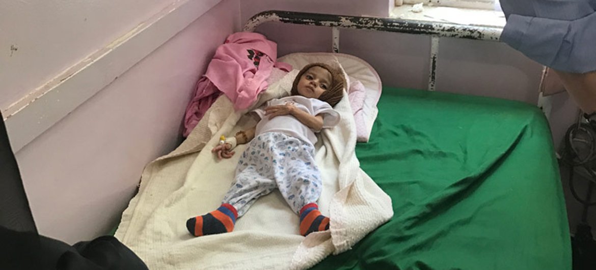 A malnourished child inside a hospital in Sana’a, Yemen.