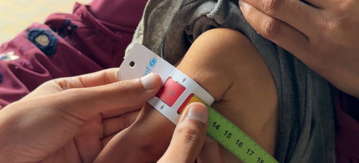 A growing number of children are being screened for malnutrition in Gaza.